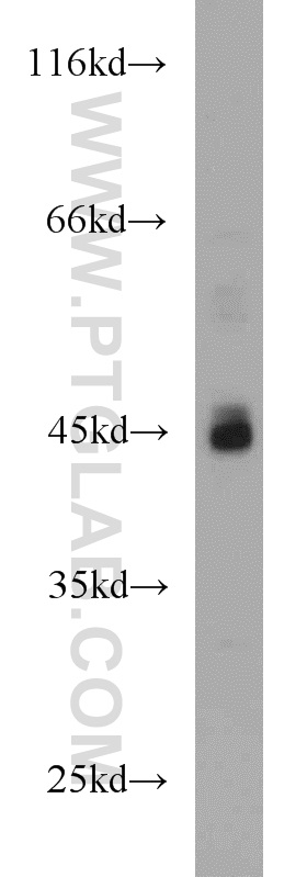 ADA Polyclonal antibody