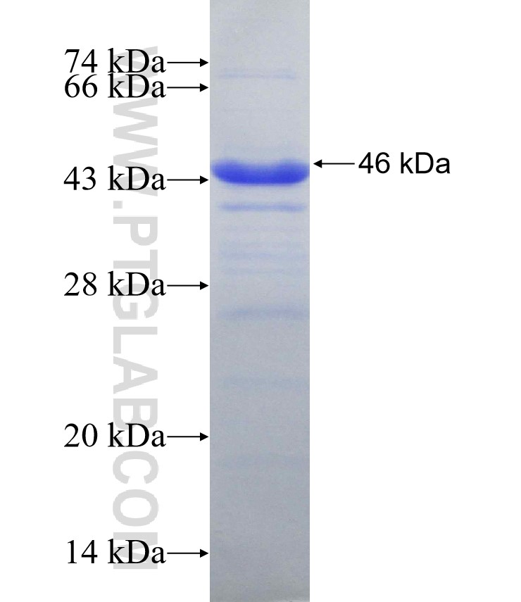 ADA fusion protein Ag31326 SDS-PAGE