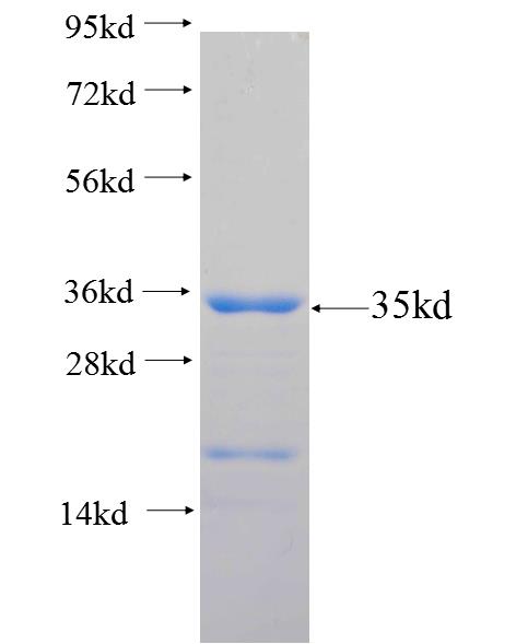 ADAD1 fusion protein Ag25966 SDS-PAGE