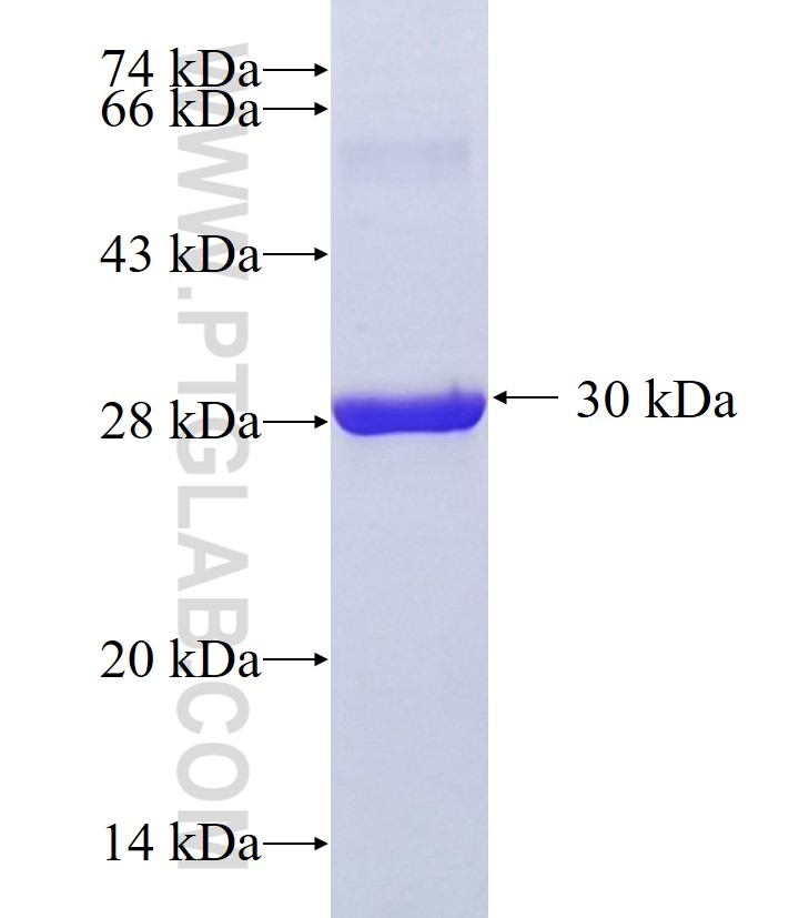 ADAD2 fusion protein Ag36554 SDS-PAGE