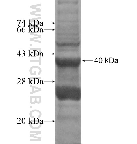 ADAD2 fusion protein Ag15650 SDS-PAGE