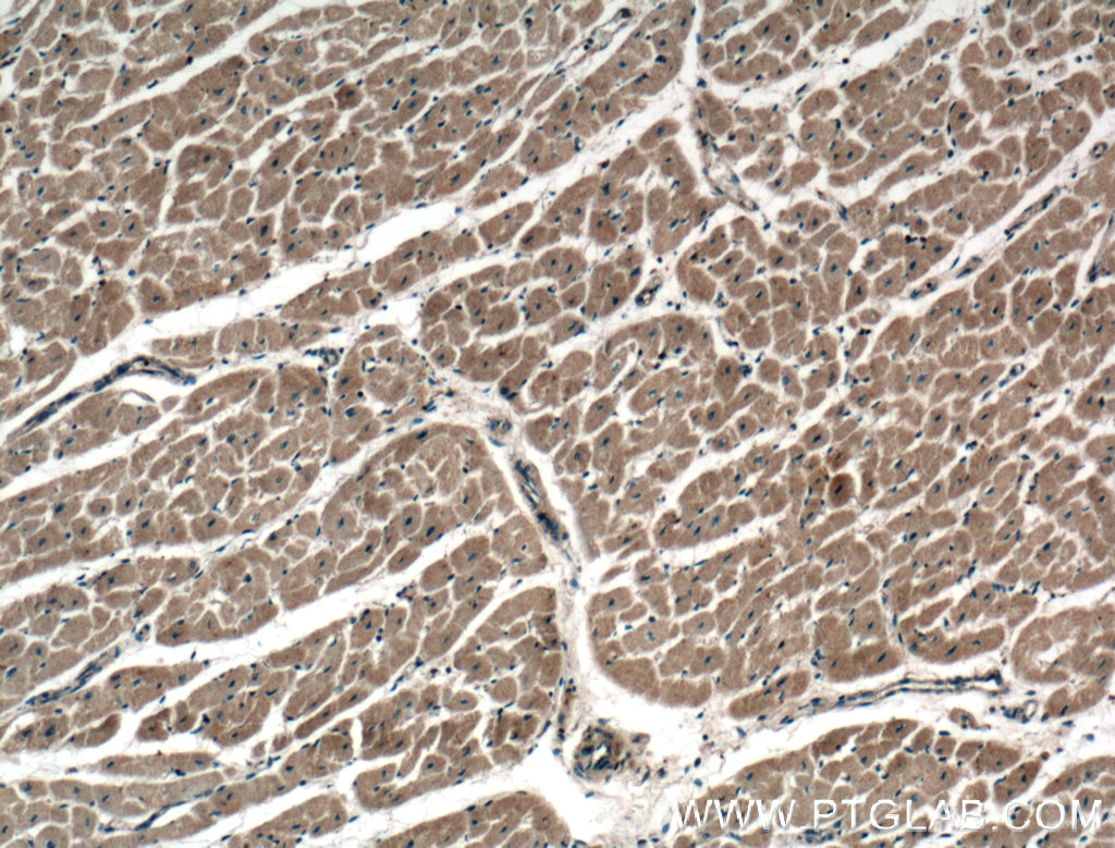 IHC staining of human heart using 27369-1-AP