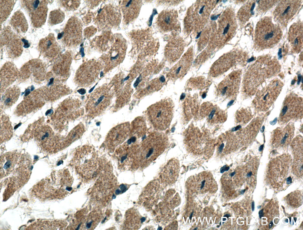 IHC staining of human heart using 27369-1-AP