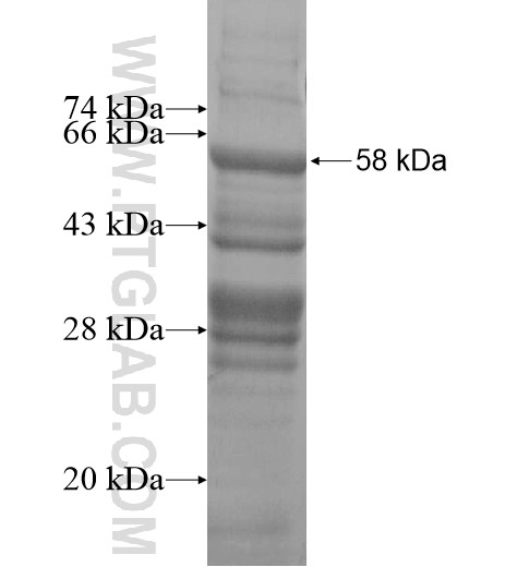 ADAL fusion protein Ag12114 SDS-PAGE ADAL fusion protein Ag12114 SDS-PAGE
