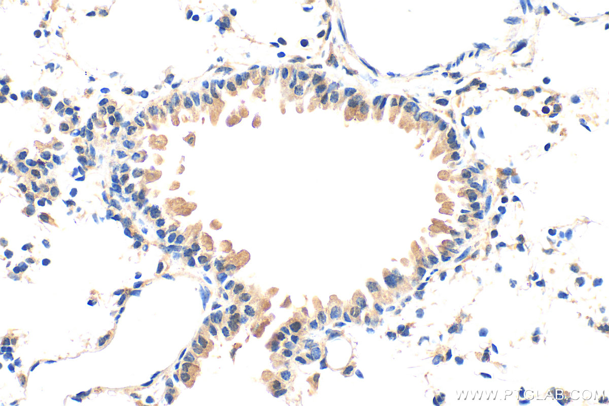 IHC staining of mouse lung using 32970-1-AP