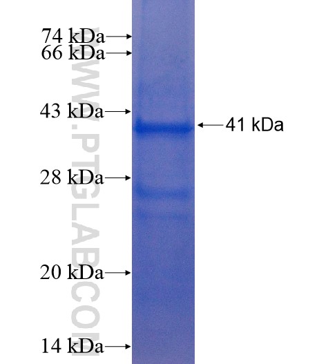 ADAM12 fusion protein Ag5245 SDS-PAGE ADAM12 fusion protein Ag5245 SDS-PAGE