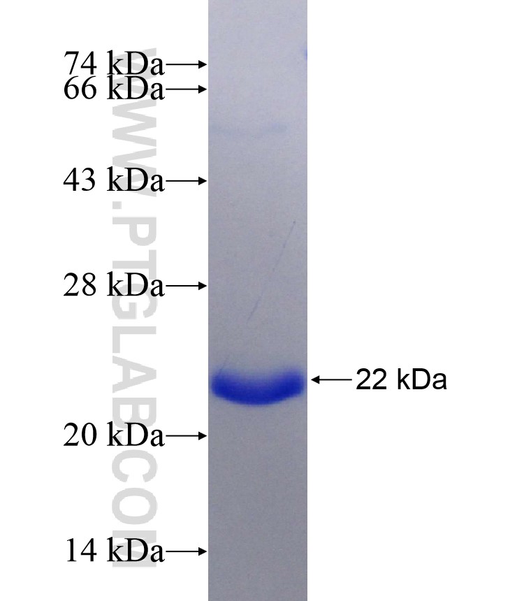 ADAM15 fusion protein Ag26885 SDS-PAGE