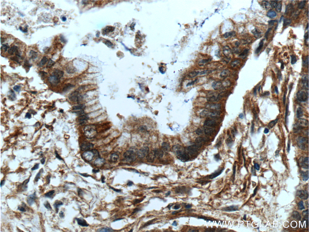 ADAM17 Polyclonal antibody