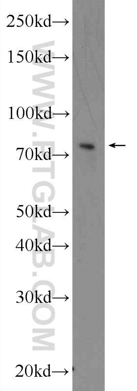 WB analysis of U-937 using 24620-1-AP