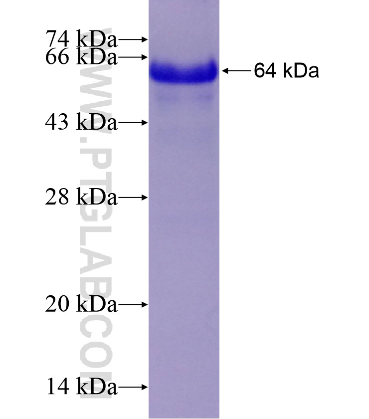 ADAM17 fusion protein Ag18273 SDS-PAGE