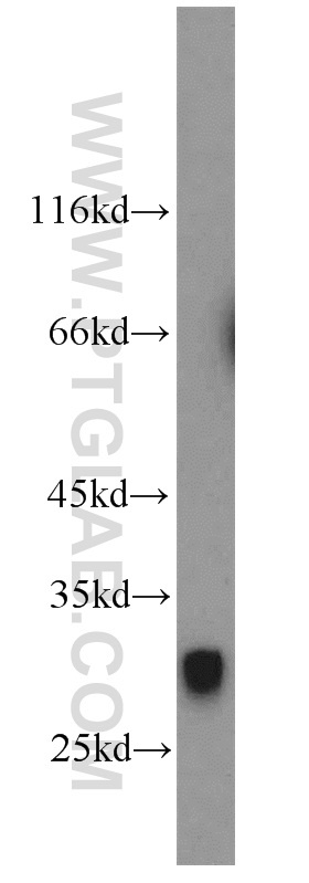 WB analysis of human placenta using 20259-1-AP