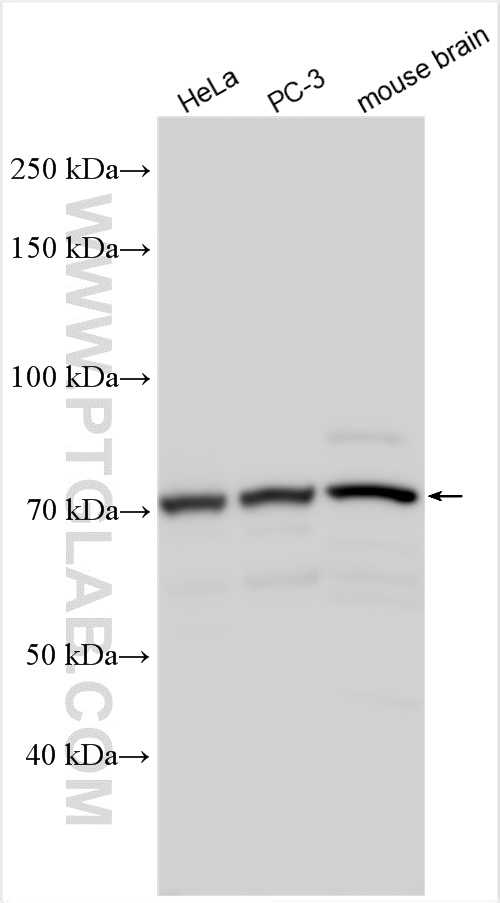 WB analysis using 20755-1-AP