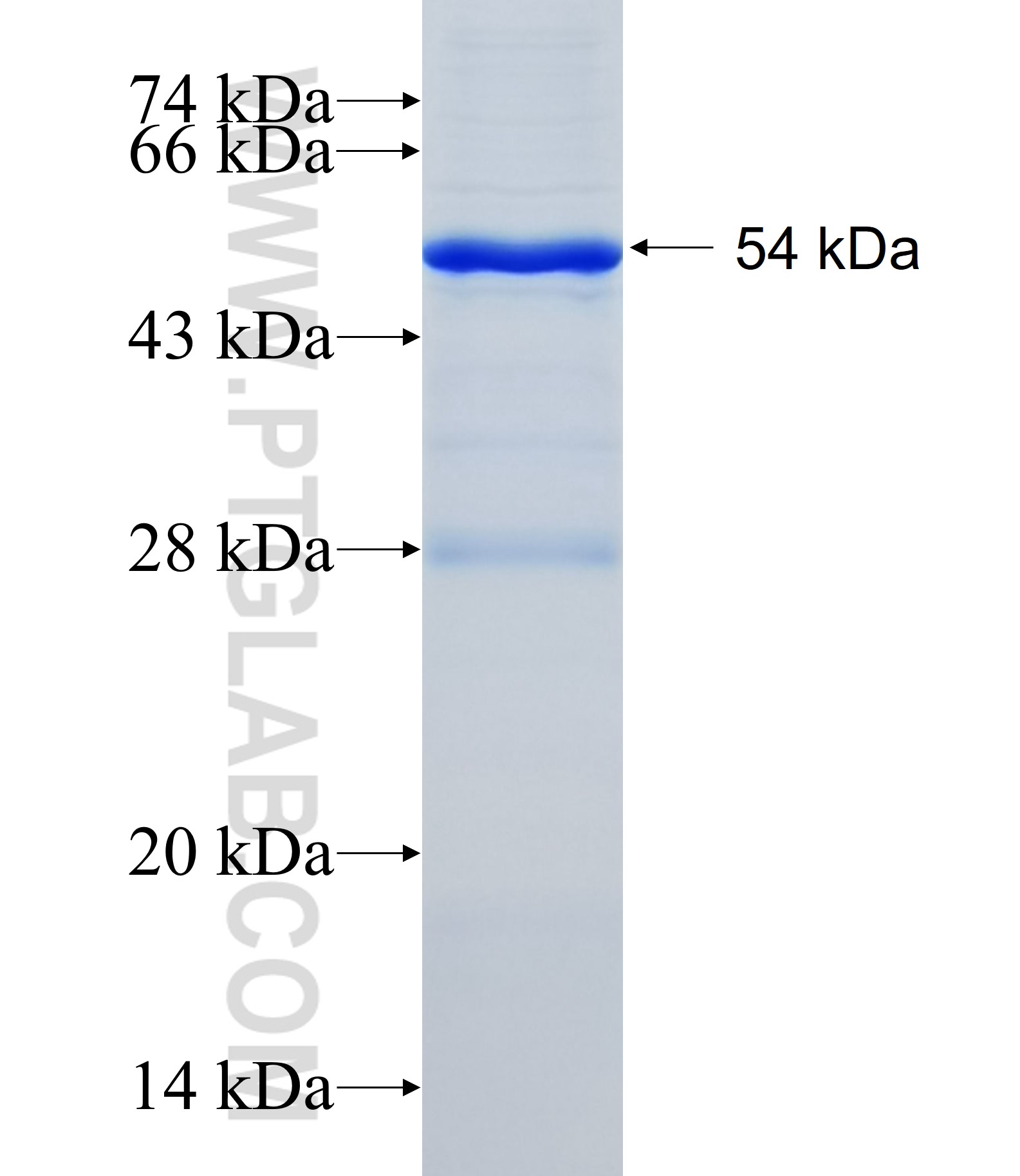 ADAM20 fusion protein Ag25814 SDS-PAGE