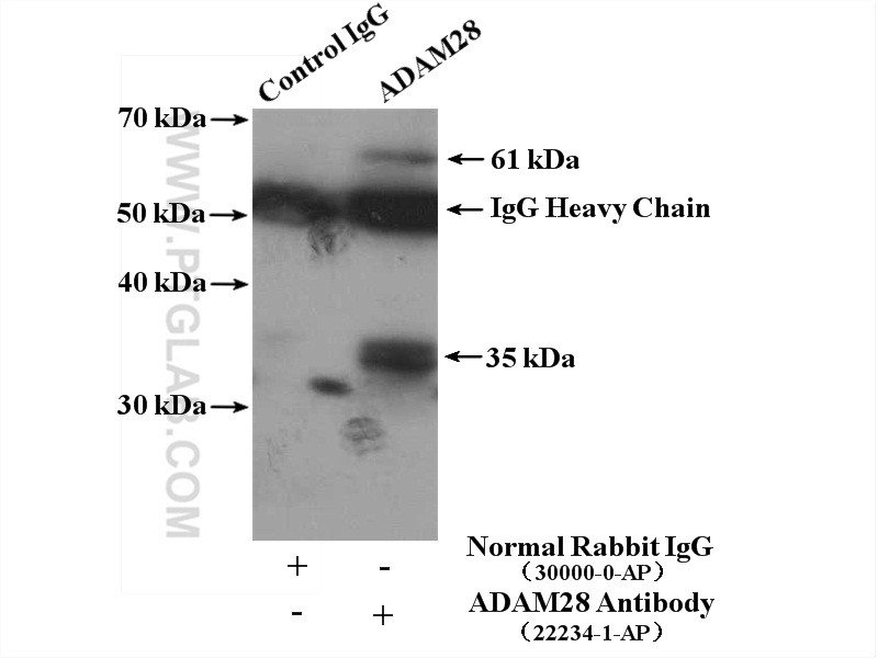 IP experiment of mouse lung using 22234-1-AP