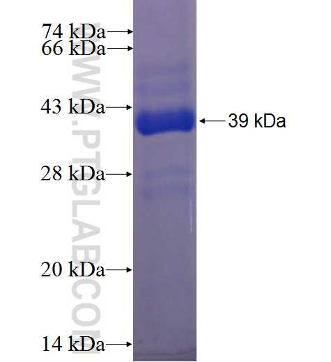 ADAM30 fusion protein Ag24567 SDS-PAGE