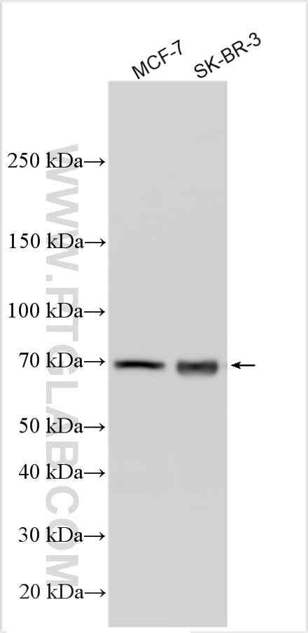 WB analysis using 22860-1-AP