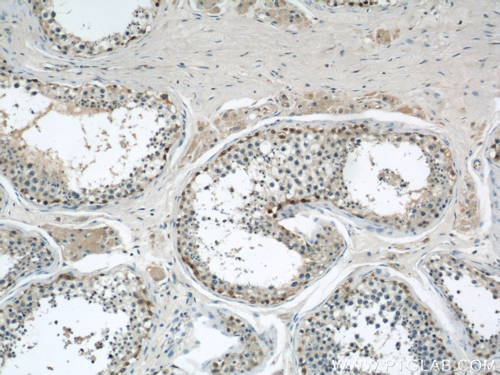 IHC staining of human testis using 22147-1-AP (same clone as 22147-1-PBS)