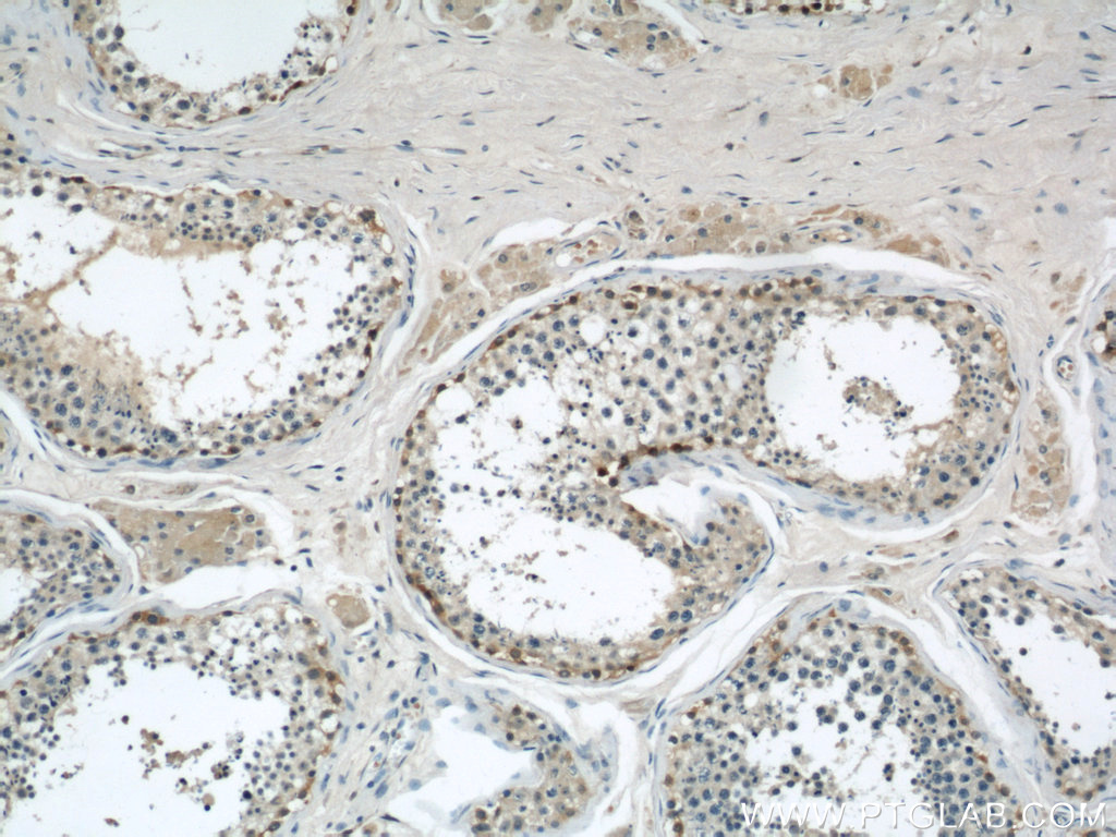 IHC staining of human testis using 22147-1-AP