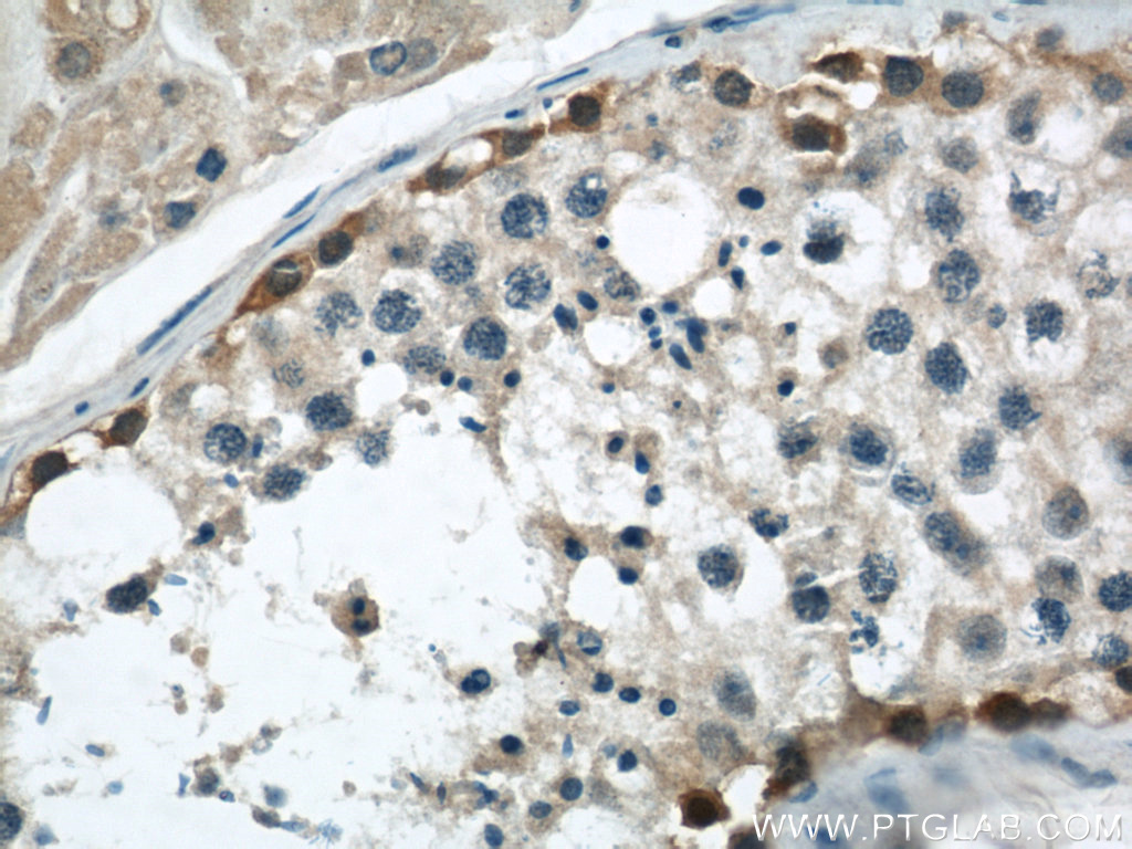 IHC staining of human testis using 22147-1-AP (same clone as 22147-1-PBS)