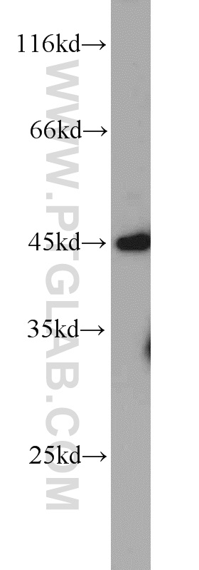 WB analysis of HeLa using 22147-1-AP