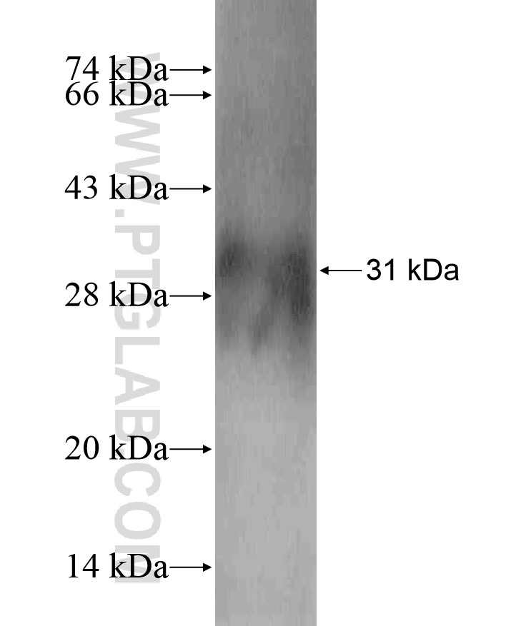 ADAM5P fusion protein Ag18018 SDS-PAGE ADAM5P fusion protein Ag18018 SDS-PAGE