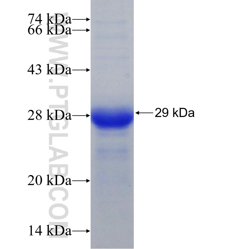 ADAM8 fusion protein Ag30736 SDS-PAGE ADAM8 fusion protein Ag30736 SDS-PAGE