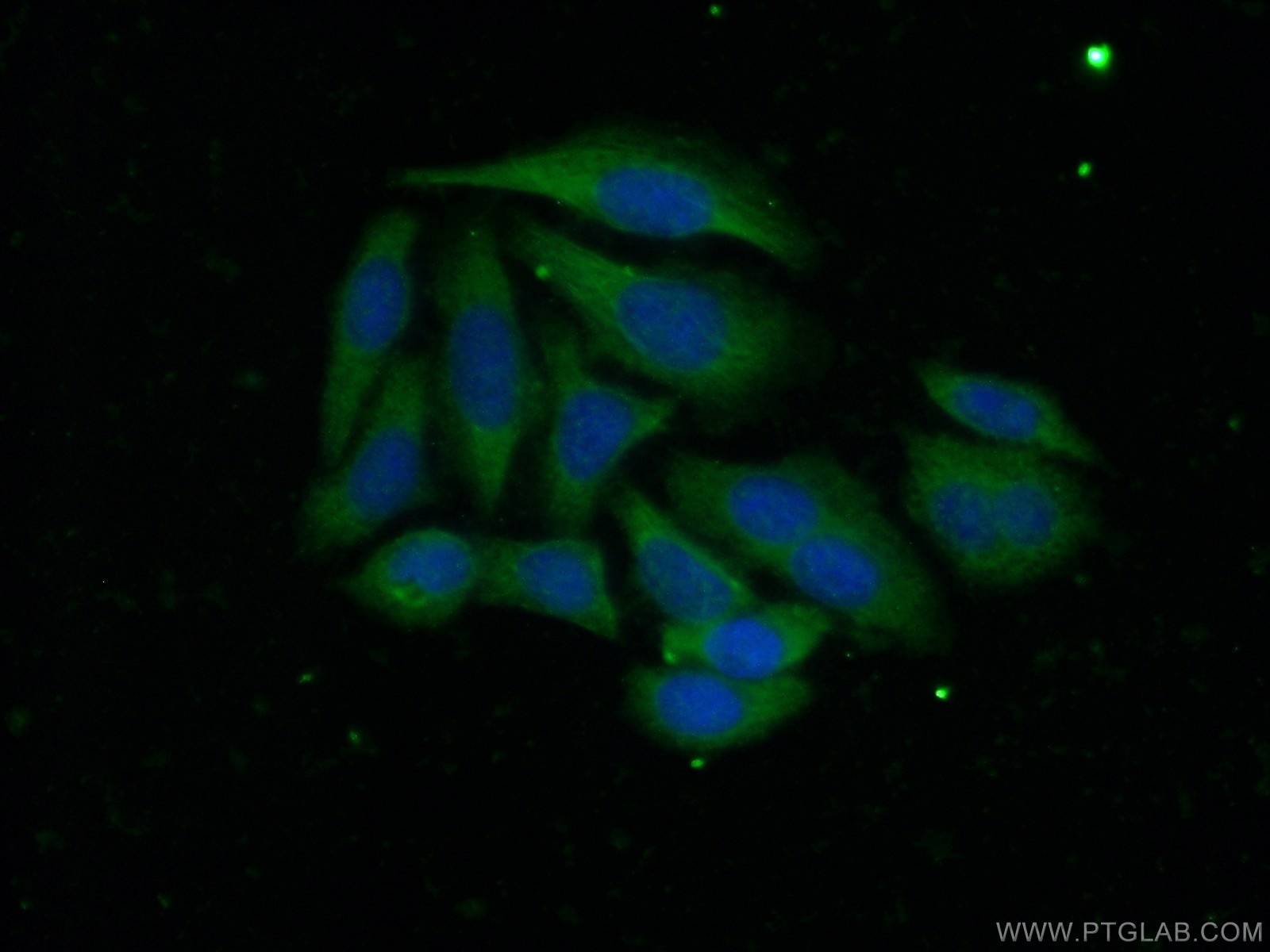 IF Staining of HepG2 using 12749-1-AP