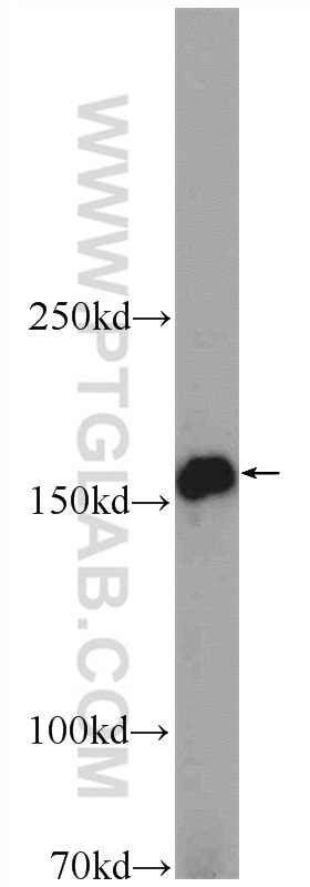 WB analysis of mouse placenta using 24934-1-AP