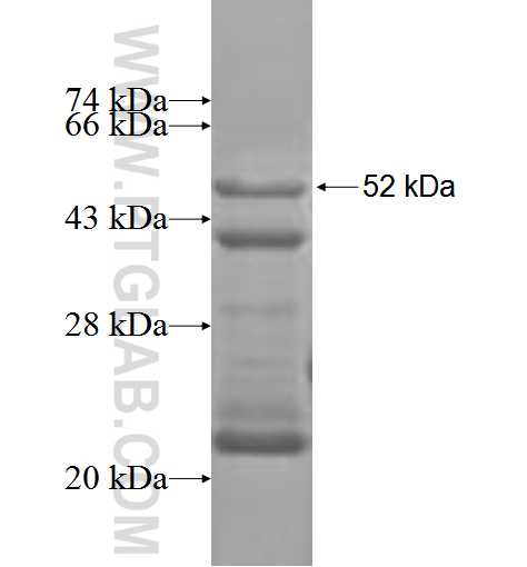 ADAMTS12 fusion protein Ag3480 SDS-PAGE ADAMTS12 fusion protein Ag3480 SDS-PAGE