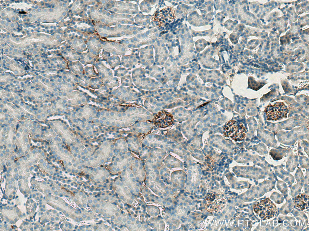 IHC staining of mouse kidney using 20737-1-AP
