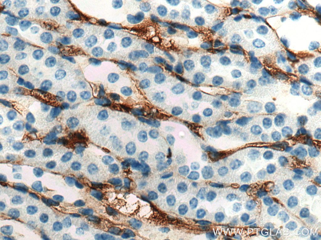 IHC staining of mouse kidney using 20737-1-AP