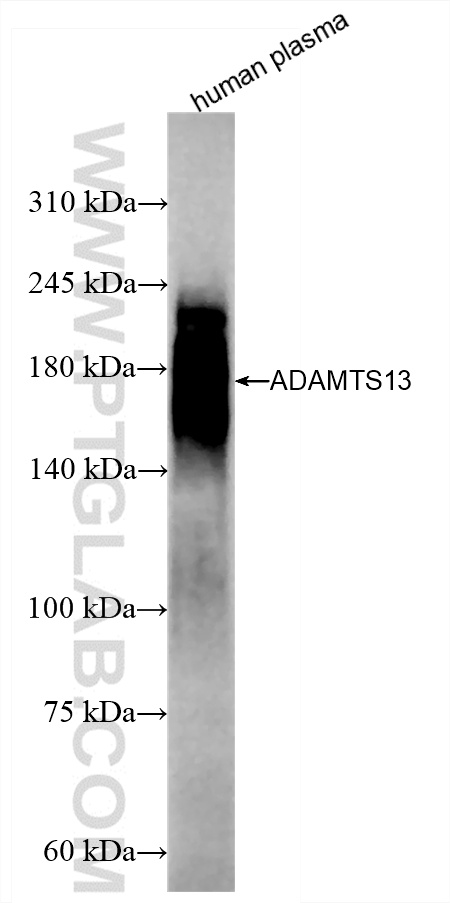 WB analysis of human plasma using 85974-3-RR (same clone as 85974-3-PBS)