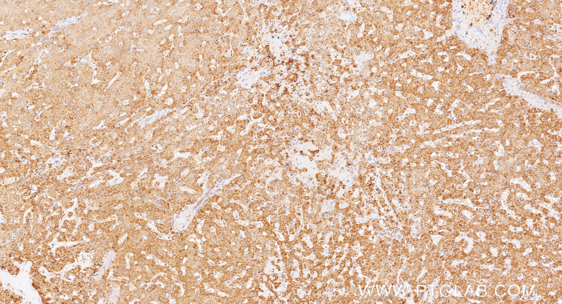 IHC staining of human liver using 98468-2-RR (same clone as 98468-2-PBS) IHC staining of human liver using 98468-2-RR (same clone as 98468-2-PBS)