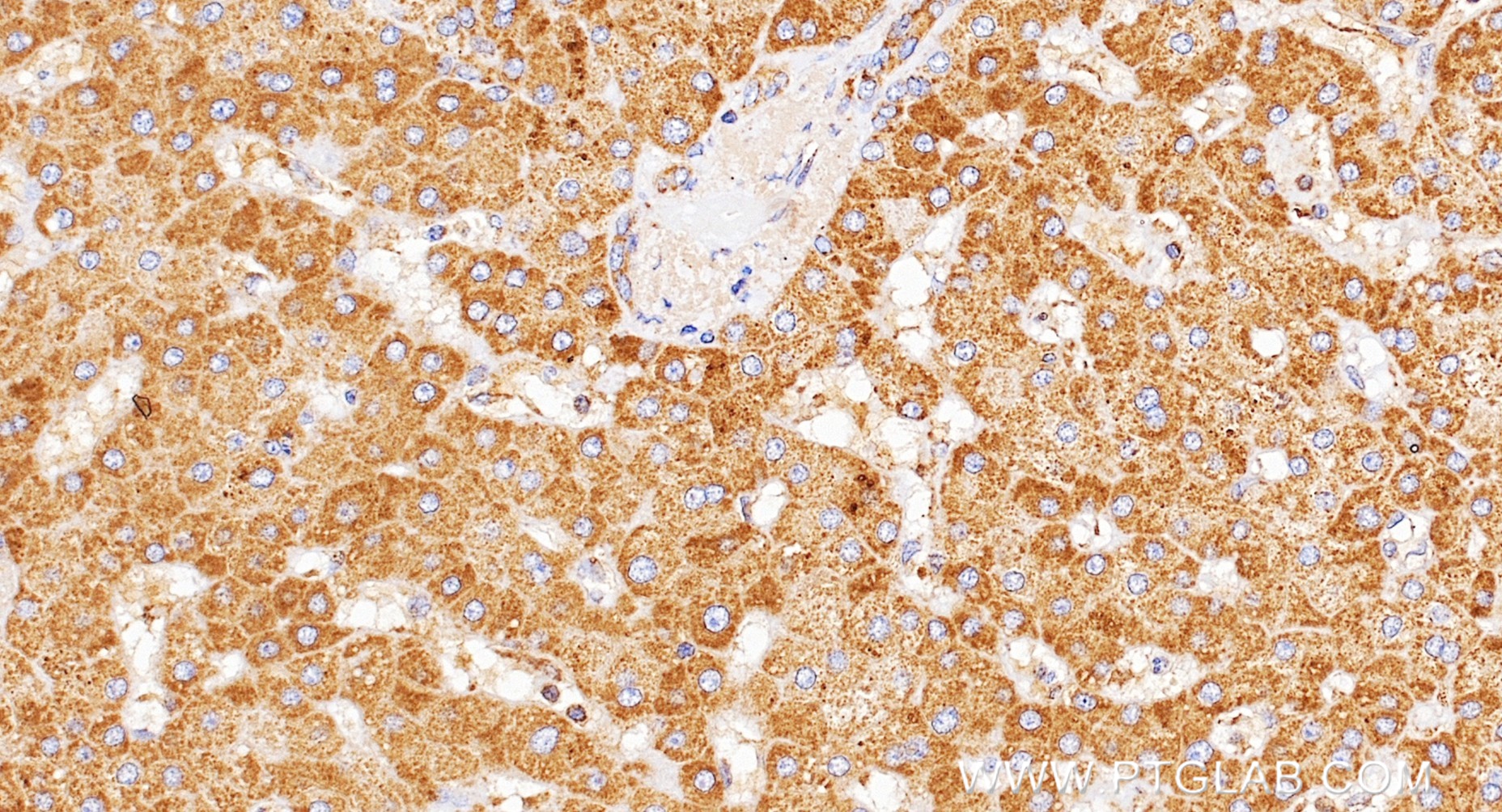 IHC staining of human liver using 98468-2-RR (same clone as 98468-2-PBS) IHC staining of human liver using 98468-2-RR (same clone as 98468-2-PBS)