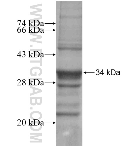 ADAMTS15 fusion protein Ag15177 SDS-PAGE ADAMTS15 fusion protein Ag15177 SDS-PAGE