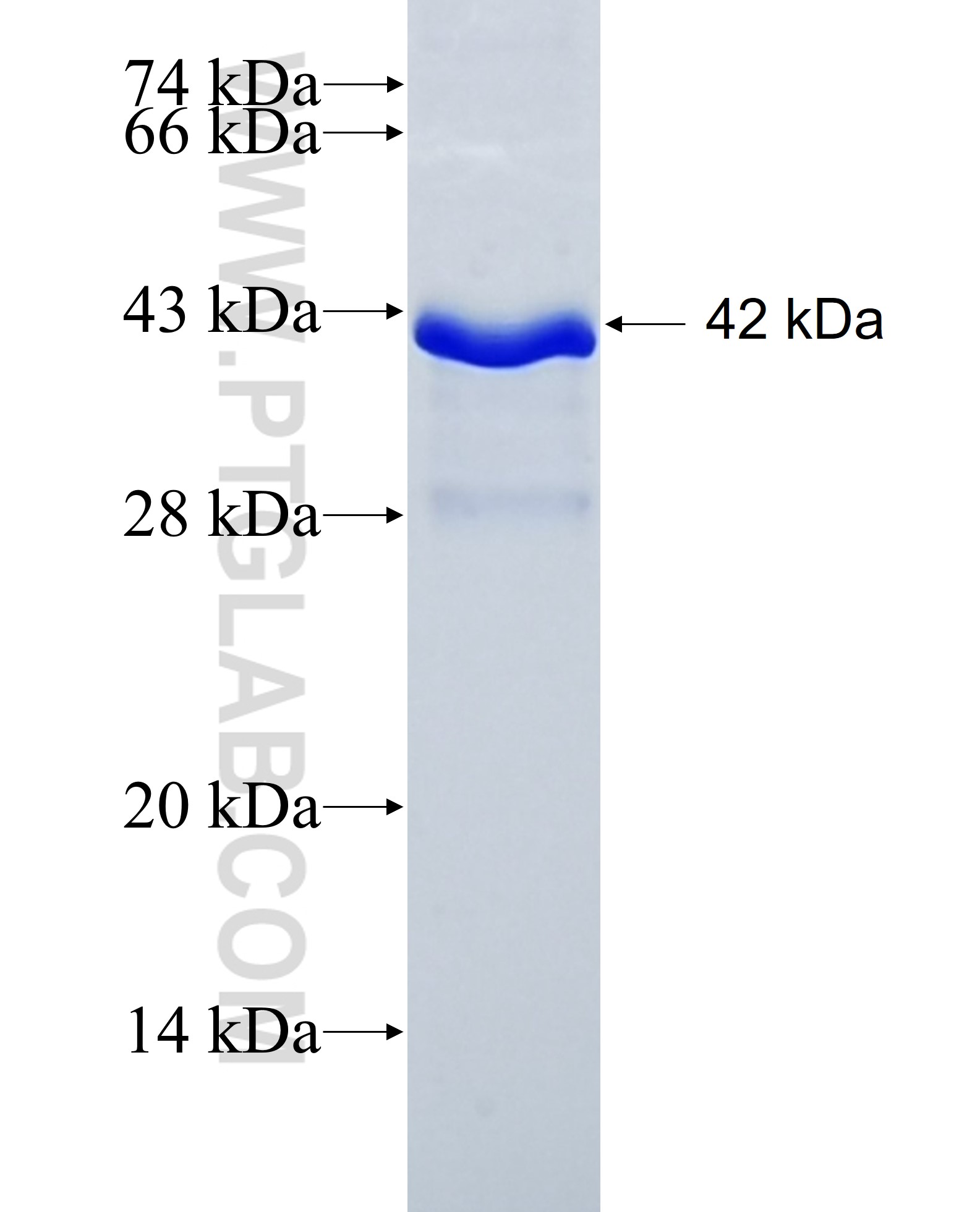 ADAMTS17 fusion protein Ag31999 SDS-PAGE ADAMTS17 fusion protein Ag31999 SDS-PAGE