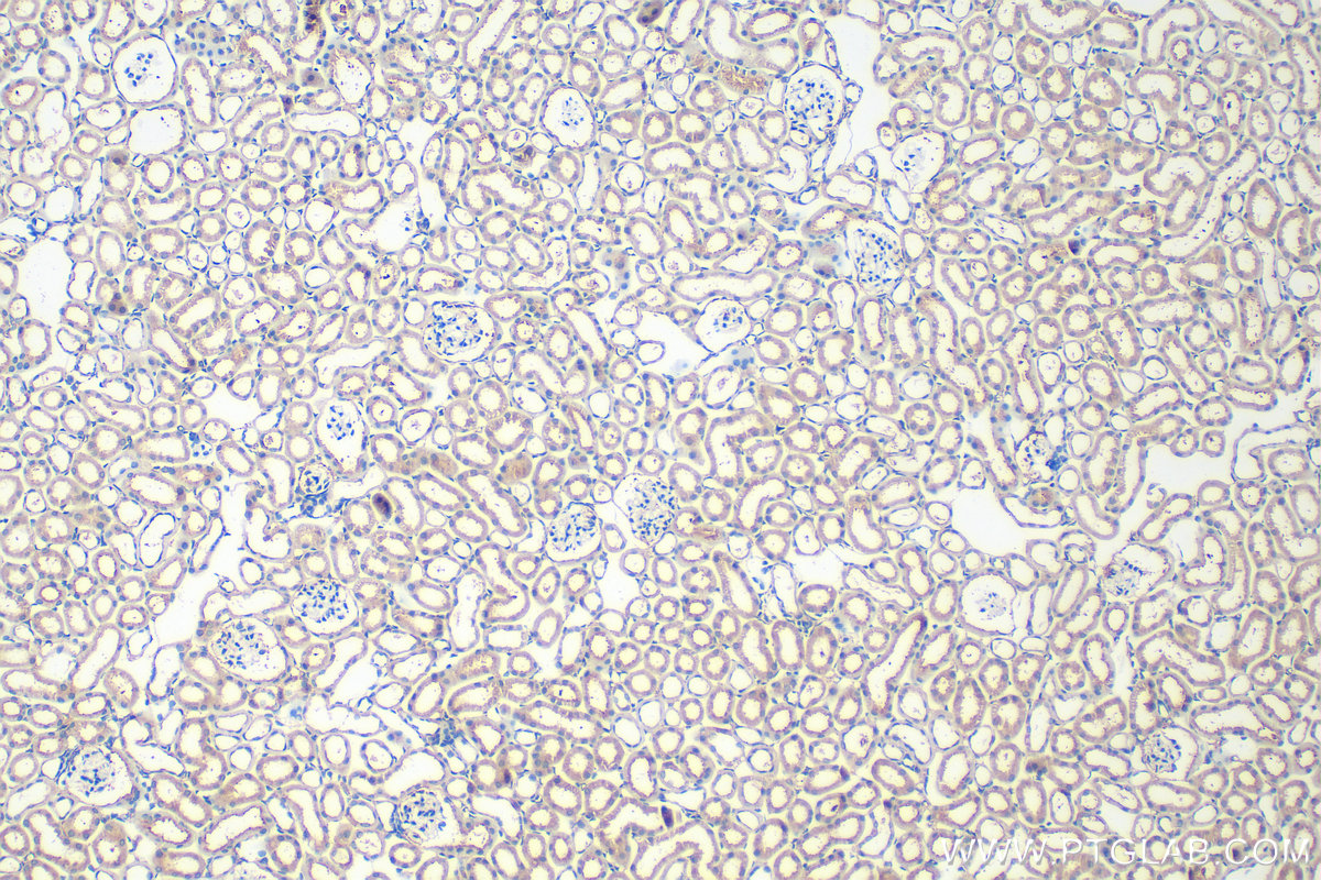 Immunohistochemical analysis of paraffin-embedded mouse kidney tissue slide using 32890-1-AP (ADAMTS19 antibody) at dilution of 1:400 (under 10x lens). Heat mediated antigen retrieval with Tris-EDTA buffer (pH 9.0). IHC staining of mouse kidney using 32890-1-AP