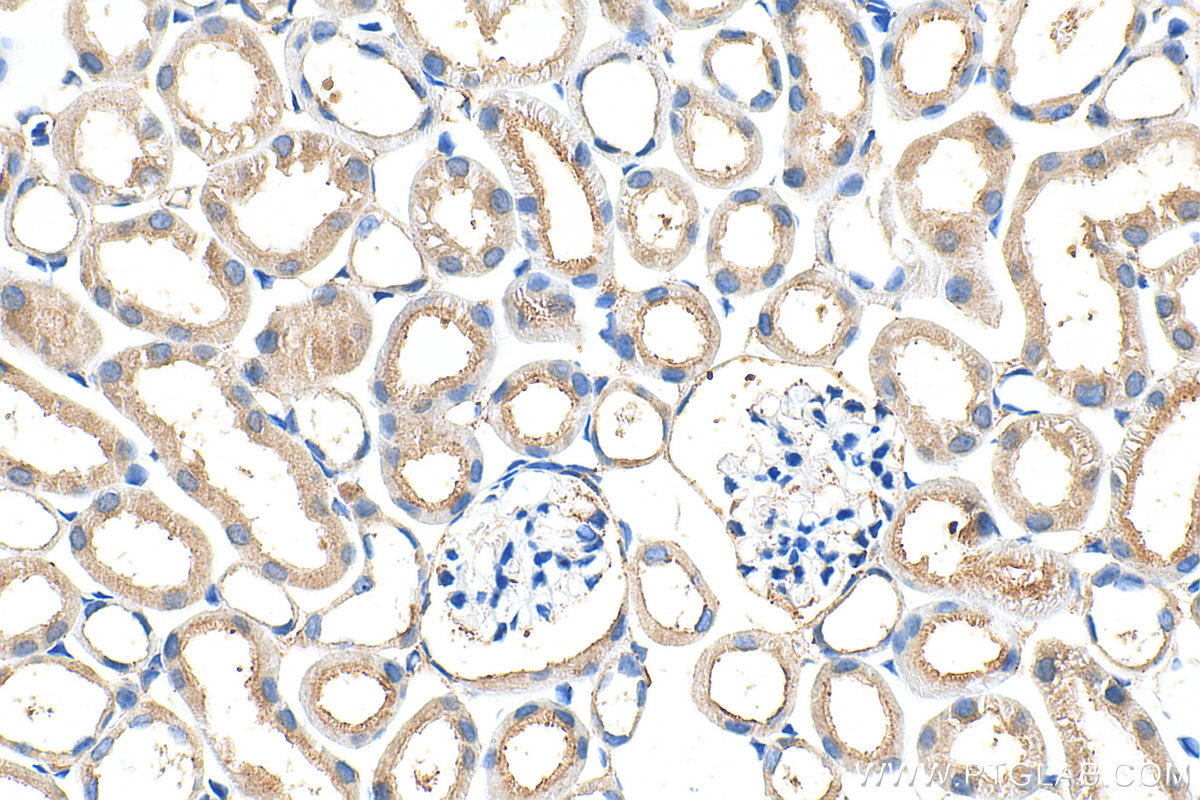 Immunohistochemical analysis of paraffin-embedded mouse kidney tissue slide using 32890-1-AP (ADAMTS19 antibody) at dilution of 1:400 (under 40x lens). Heat mediated antigen retrieval with Tris-EDTA buffer (pH 9.0). IHC staining of mouse kidney using 32890-1-AP