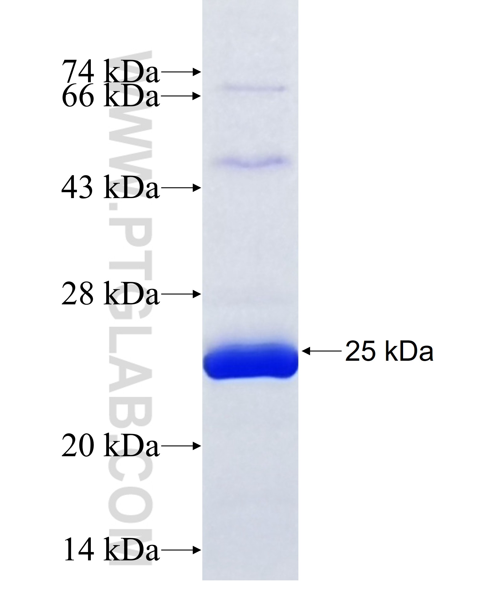ADAMTS19 fusion protein Ag36959 SDS-PAGE ADAMTS19 fusion protein Ag36959 SDS-PAGE