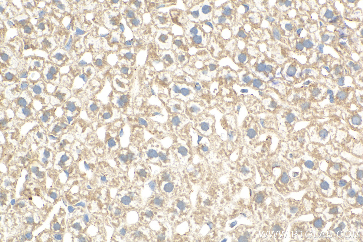 IHC staining of mouse liver using 31032-1-AP