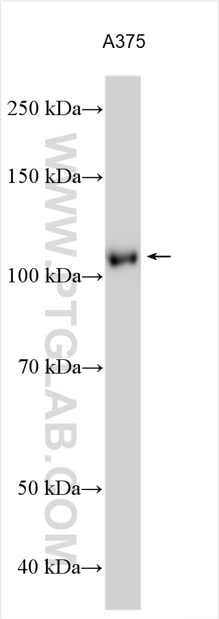WB analysis using 31032-1-AP