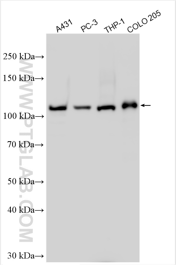 WB analysis using 31032-1-AP