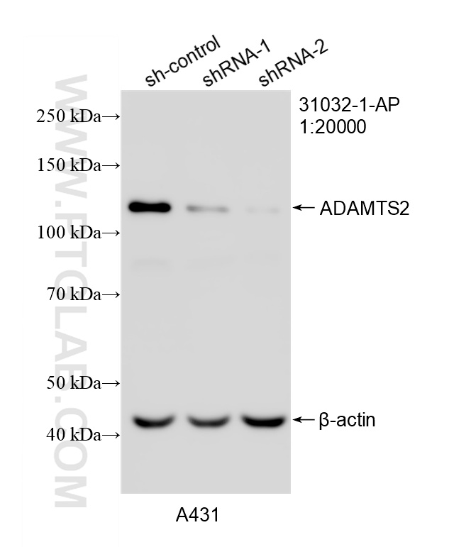 WB analysis of A431 using 31032-1-AP