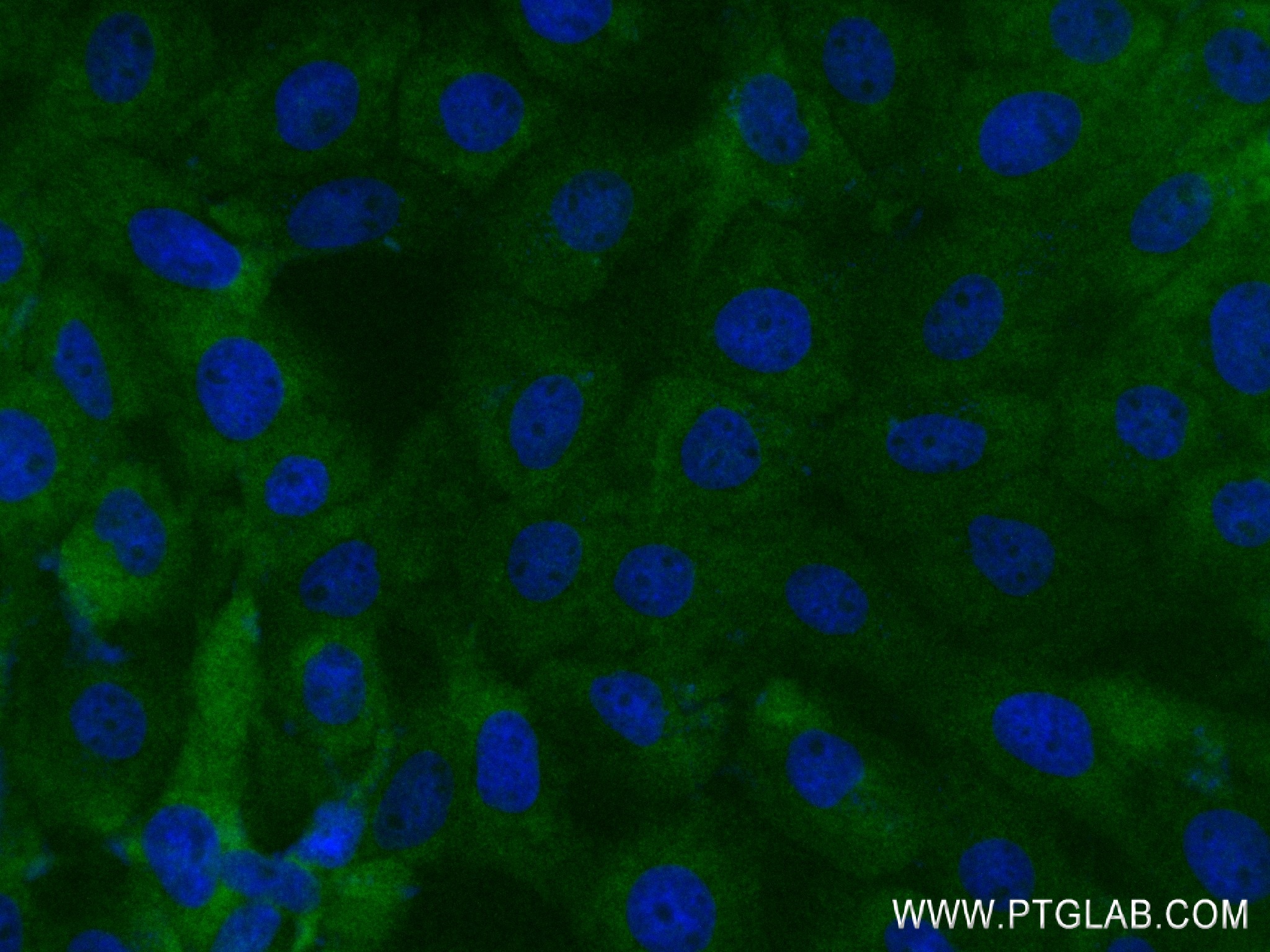 IF Staining of A431 using 84476-6-RR (same clone as 84476-6-PBS)