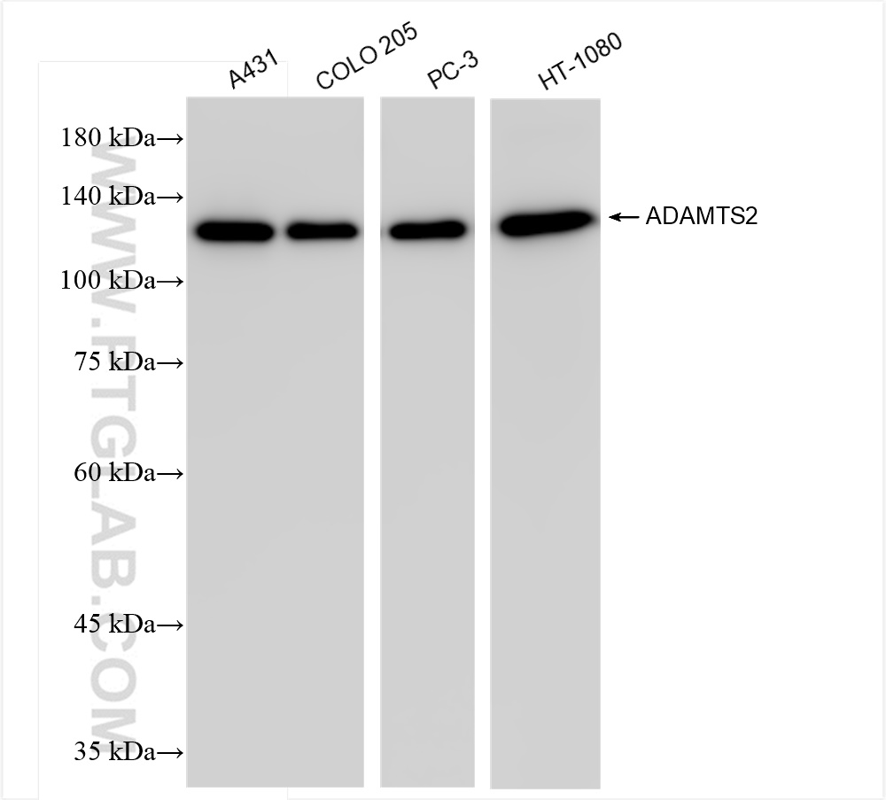 WB analysis using 84476-6-RR (same clone as 84476-6-PBS)
