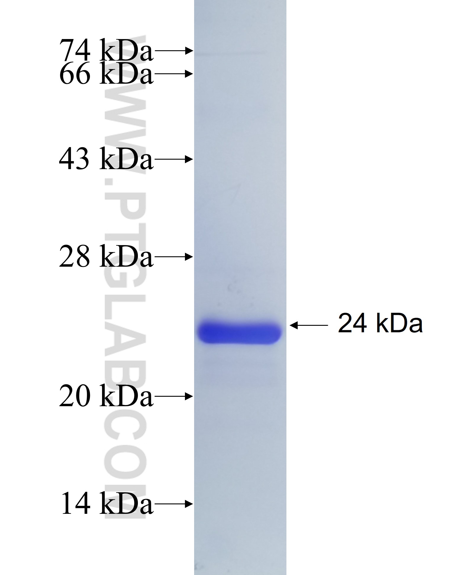 ADAMTS2 fusion protein Ag34984 SDS-PAGE ADAMTS2 fusion protein Ag34984 SDS-PAGE