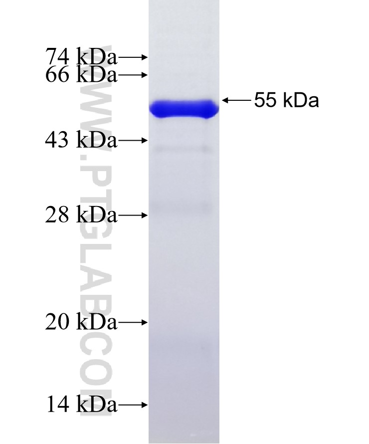 ADAMTS6 fusion protein Ag29535 SDS-PAGE