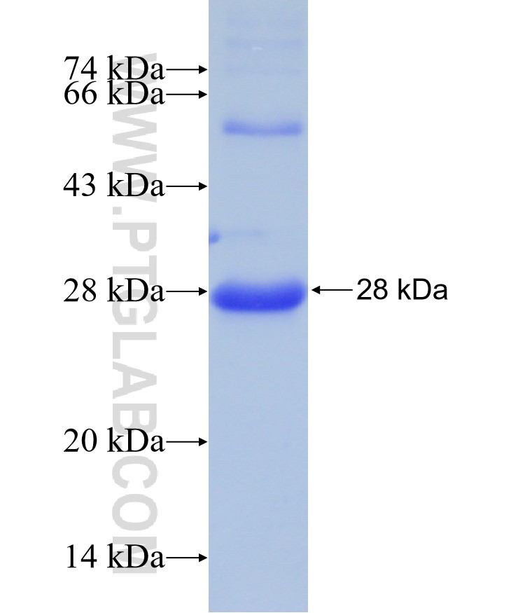 ADAMTS6 fusion protein Ag29556 SDS-PAGE ADAMTS6 fusion protein Ag29556 SDS-PAGE
