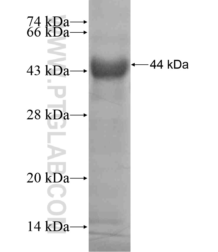 ADAMTS9 fusion protein Ag17693 SDS-PAGE ADAMTS9 fusion protein Ag17693 SDS-PAGE