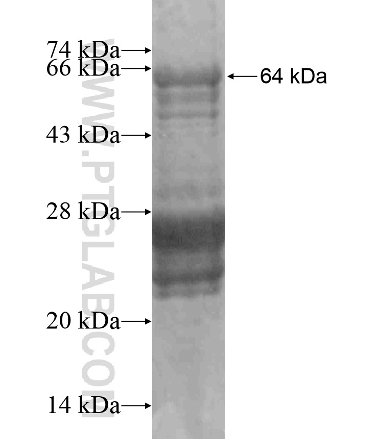 ADAMTSL2 fusion protein Ag17545 SDS-PAGE ADAMTSL2 fusion protein Ag17545 SDS-PAGE